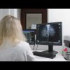 Tumori: a Milano il punto su test genomici e percorsi di cura nel carcinoma mammario