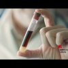 Tumori: seno metastatico, a Milano oncologi e pazienti chiedono accesso equo alla biopsia liquida