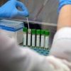 Mers, 9 casi con due morti in Arabia Saudita. Oms: “Rischio moderato”