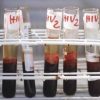 Salute, da Hiv a infezioni sessuali lotta a sommerso, al via settimana europea test