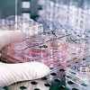 Fecondazione, non solo endometriosi: il nuovo protocllo che combatte l’adenomiosi