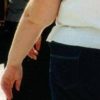 Salute: allerta endocrinologi, obesità triplicata in donne e raddoppiata in uomini