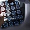 Rallentare l’Alzheimer con il litio, scoperta la ‘scintilla’ che innesca la patologia?