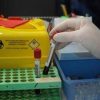 Alzheimer, via libera a test del sangue per diagnosi: cosa significa