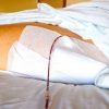 Fine vita, Sin: “Cure palliative fondamentali per pazienti neurologici”