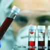 Giornata Ail, con ricerca e cura a fianco dei pazienti con neoplasie del sangue