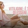 Salute, Giornata vitiligine: al via campagna ‘Oltre falsi miti verso nuove possibilità’