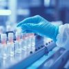 Tumore al seno avanzato, nuova terapia ormonale riduce rischio progressione del 56%