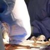 Bimba piuma operata al cuore a Milano, salvata da San Raffaele-San Donato