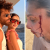 Can Yaman, la fidanzata Sara Bluma denuncia le violenze dell’ex. L’attore: “Ti amo”
