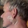 Gordon Ramsay: “Operato per tumore della pelle”