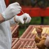 Aviaria, negli Usa primo caso umano al mondo: morto il paziente infettato dal virus