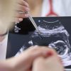 Chirurgia, si rompe l’aorta e viene operata con il bimbo in utero, intervento record a Milano