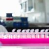 Milano, focolaio di tubercolosi all’Istituto di Medicina legale: 8 casi conclamati e 7 positivi. Indagini sull’origine del contagio