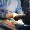 Operata al femore a 104 anni, già in piedi il giorno successivo all’intervento
