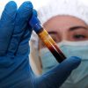 Hantavirus, negativo il turista inglese in quarantena a Milano. Test per una donna ricoverata a Messina