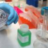 Cancro alla vescica, Berardi (Aiom): “Sangue nelle urine segnale da non sottovalutare”