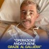 Marco Bucci operato al Galliera per la ricostruzione cutanea al naso: “Sto bene”
